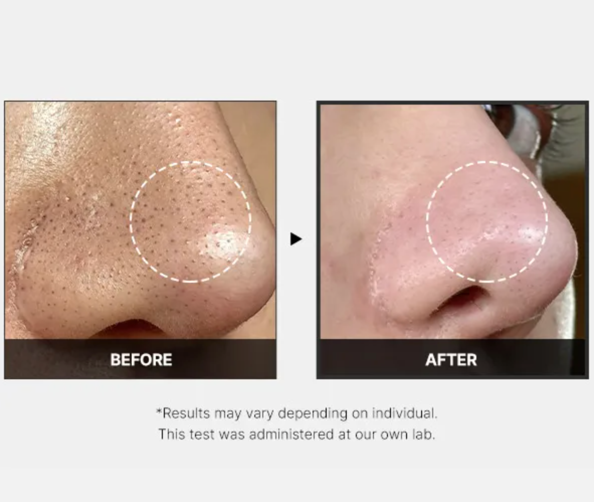 medicube One Day Exosome Shot Pore Ampoule 2000 30ml