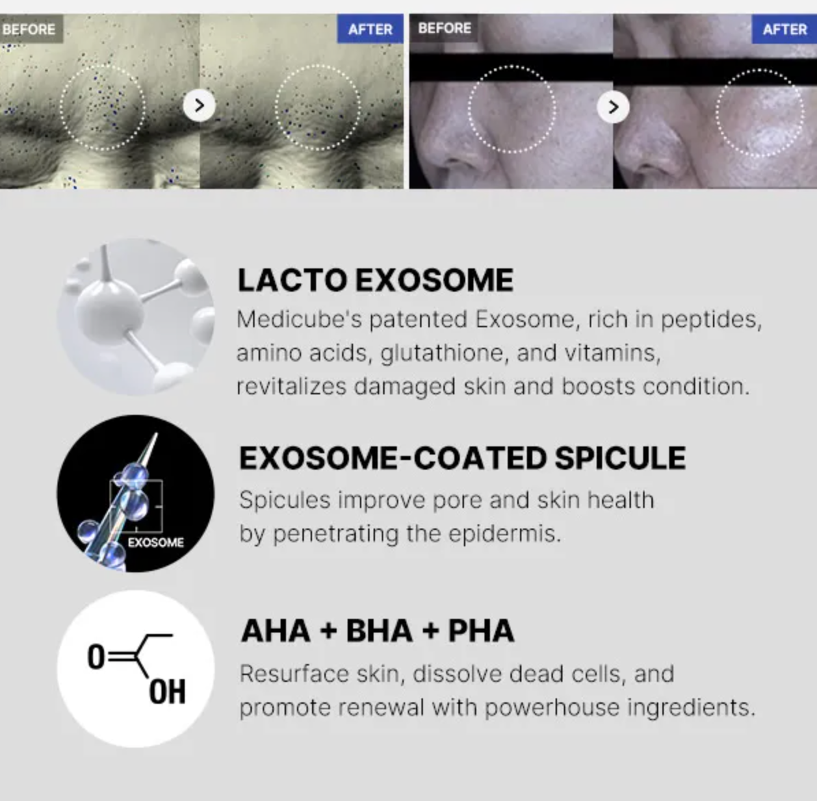 medicube One Day Exosome Shot Pore Ampoule 2000 30ml