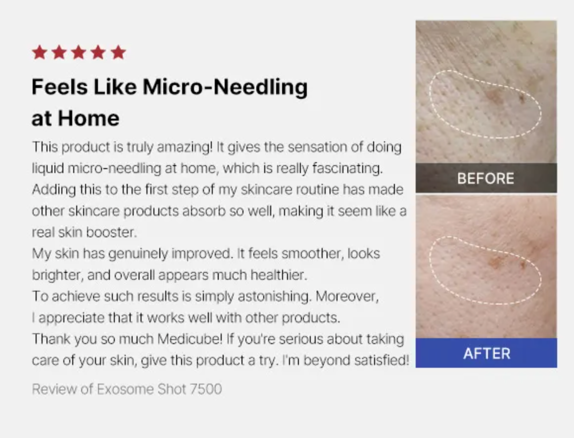 medicube One Day Exosome Shot Pore Ampoule 2000 30ml